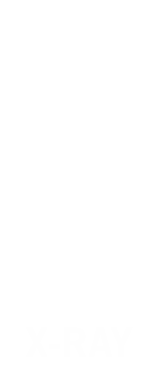 X Ray Badge Buddy For Vertical ID Cards